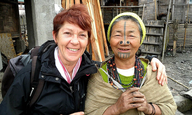 Làm đẹp kinh dị: "Cải tạo" bản thân, đục mũi để đẹp - Ảnh 5.