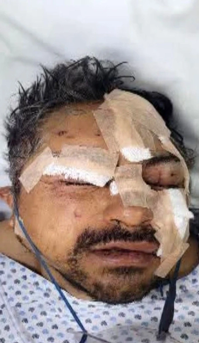 Người đàn ông bị tấn công với nhiều vết thương nghiêm trọng. Ảnh: Press