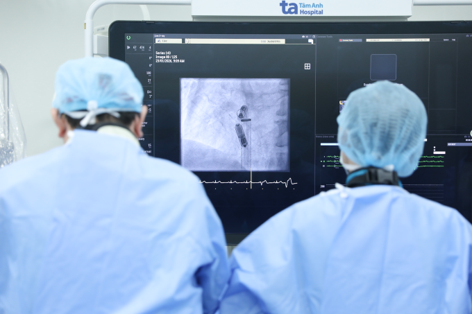 Giáo sư Nhân (trái) và êkíp cấy máy tạo nhịp tim nhỏ bằng viên thuốc con nhộng cho bệnh nhân. Ảnh: Bệnh viện Đa khoa Tâm Anh