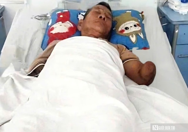 Bất ngờ vụ cụ ông bị hổ mang cắn vẫn cố giữ chặt con rắn: Gia đình nhận hơn 300 triệu, xin ngừng kêu gọi- Ảnh 1.