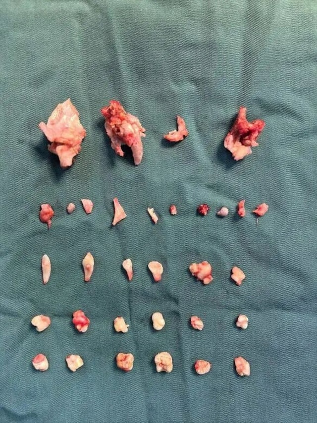 Cô gái đau bụng dữ dội, bác sĩ phát hiện ra bí mật bên trong - Ảnh 1.