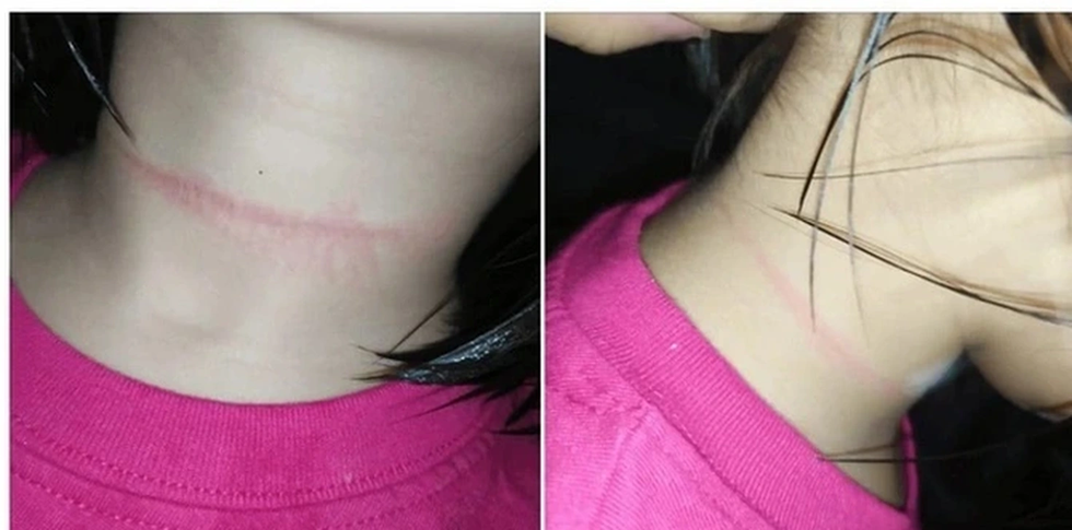 Nam sinh co giật sau khi thử “ngủ 6 giây” trên TikTok: Trào lưu nguy hiểm có thể gây chết người - Ảnh 3.