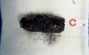 Nam sinh lớp 8 co giật sau khi thử “ngủ 6 giây” trên TikTok: Báo động trào lưu nguy hiểm chết người - Ảnh 5.