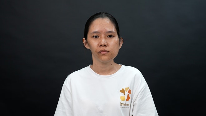 Hành trình lột xác mùa 7: Lan tỏa thông điệp 'Sống một đời rực rỡ'- Ảnh 7. Hành trình lột xác mùa 7: Lan tỏa thông điệp 'Sống một đời rực rỡ'- Ảnh 7.