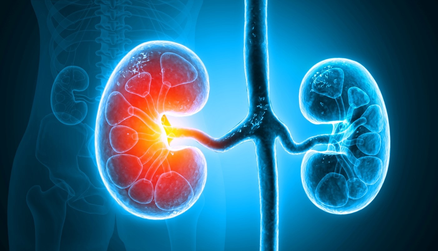 bệnh thận mạn tại Việt Nam.jpg