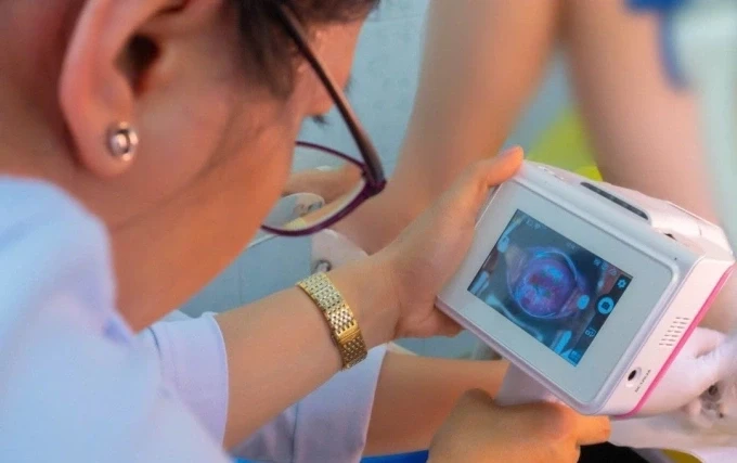 Bác sĩ Bệnh viện Hùng Vương ứng dụng AI tầm soát ung thư cổ tử cung cho người dân tại xã đảo Thạnh An, năm 2025. Ảnh:Yến Phạm