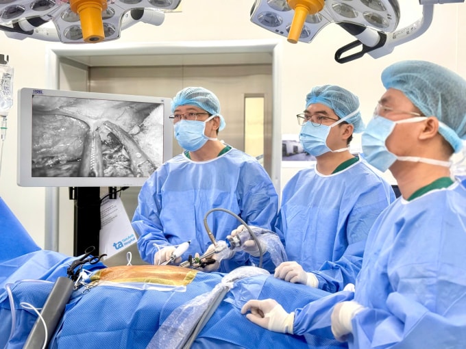 Bác sĩ Minh Hùng (ngoài cùng, bên trái) đang phẫu thuật nội soi cắt thực quản cho ông Đức. Ảnh: Bệnh viện Đa khoa Tâm Anh