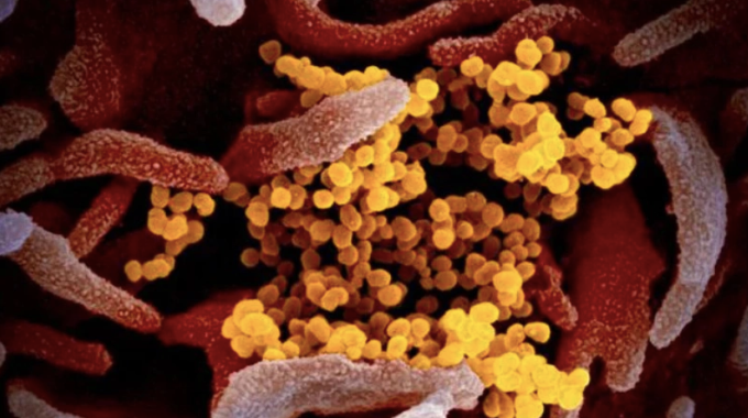 Biến thể Covid-19 mới BA.3.2 đang lan rộng tại Mỹ. Ảnh:AP