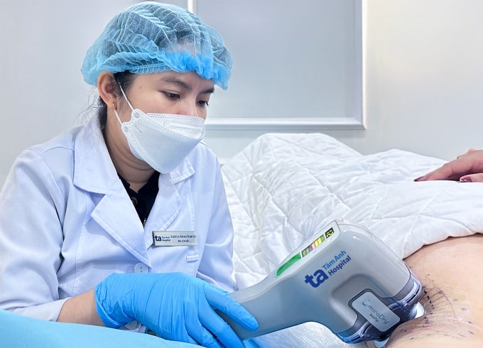 Bác sĩ Thư sử dụng công nghệ vi sóng điều trị tình trạng tăng tiết mồ hôi cho chị Lan. Ảnh: Bệnh viện Đa khoa Tâm Anh