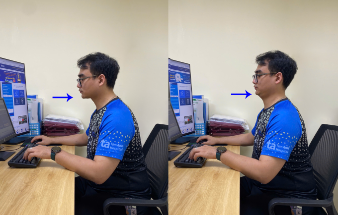 Chuyên viên vật lý trị liệu hướng dẫn bài tập thu cằm. Ảnh: Bệnh viện Đa khoa Tâm Anh