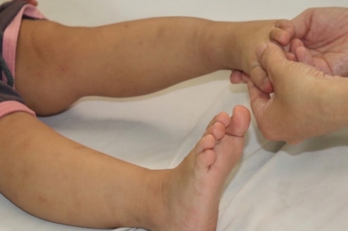 Bác sĩ thăm khám cho bệnh nhi tại Khoa Nhiễm, Bệnh viện Nhi đồng 2. Ảnh: Thúy Nguyễn