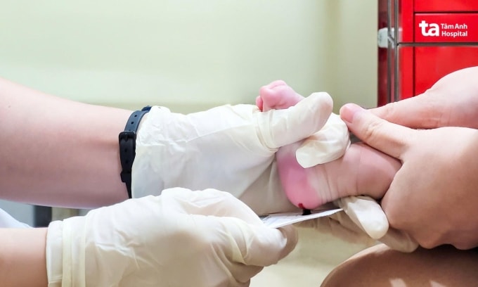 Lấy máu gót chân để xét nghiệm sàng lọc trên 100 bệnh lý cho trẻ sơ sinh. Ảnh: Bệnh viện Đa khoa Tâm Anh