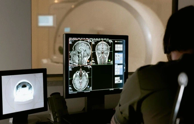 Chụp cộng hưởng từ não cho bệnh nhân. Ảnh: Theo Pexels