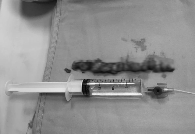 Đau lưng kéo dài tưởng xương khớp, người phụ nữ tá hỏa khi biết mình mắc bệnh nguy hiểm - Ảnh 1.