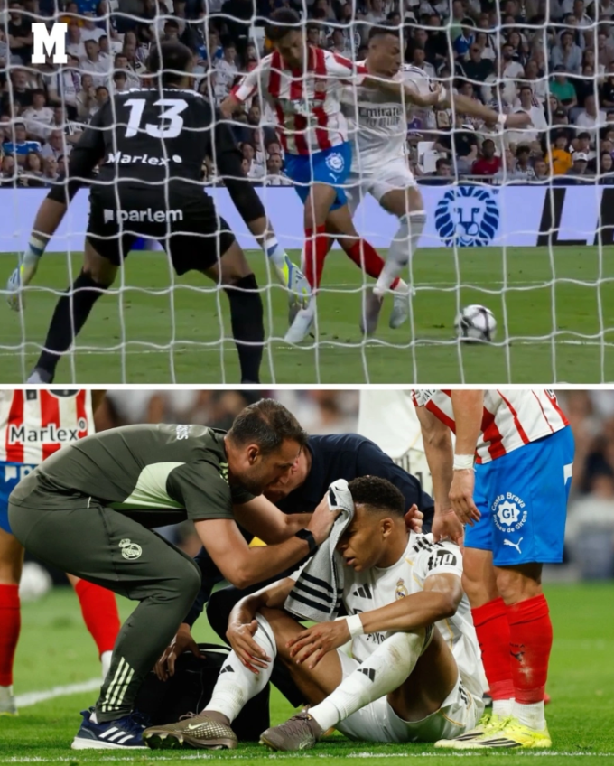 Tình huống Vitor Reis văng cùi chỏ trúng mặt, khiến Kylian Mbappe đổ máu. Ảnh: Marca