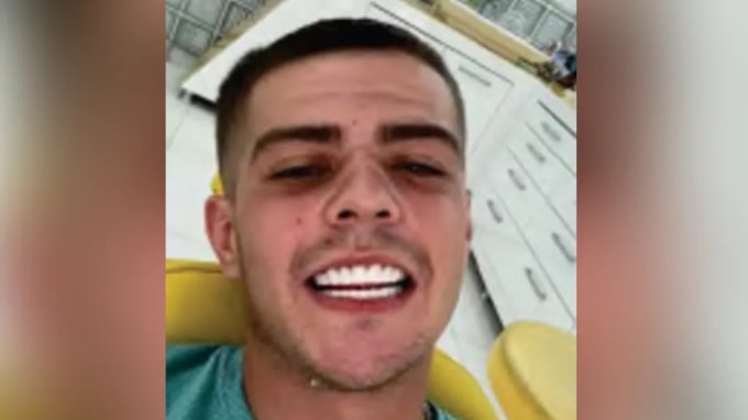 Coran Davies gửi cho bạn ảnh chụp ngồi trên ghế nha khoa với hàm răng sứ trắng sáng. Ảnh: BBC