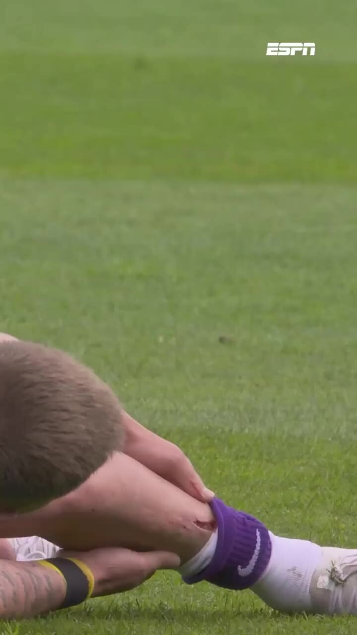 Tranh cãi vụ tuyển thủ Indonesia khiến đối thủ rách chân ở giải Hà Lan