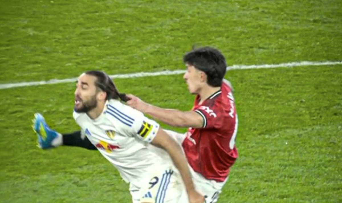 Lisandro Martinez giật tóc đối thủ.