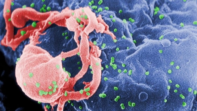 Ảnh chụp virus HIV qua kính hiển vi. Ảnh: Reuters