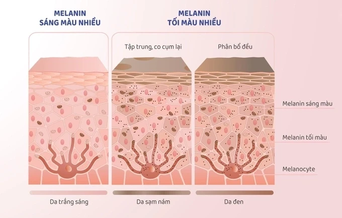 Mô tả tình trạng phân bổ các melanin sáng màu và melanin tối màu. Đồ họa: Công ty Cổ phần Dược phẩm Eco