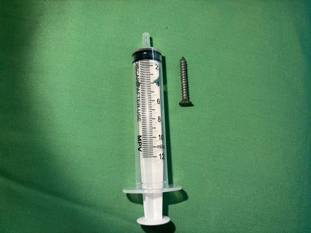 Đang chơi ở nhà, bé gần 2 tuổi nuốt phải thứ "đáng sợ" - Ảnh 1.