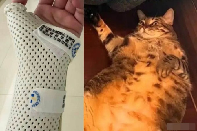 Bị mèo nặng 7,5 kg đè khi ngủ, cô gái gãy xương cổ tay