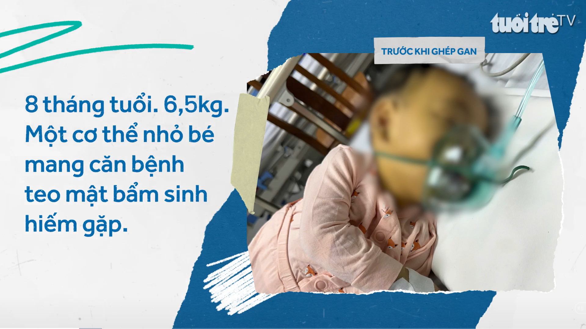 Ngay từ giây phút đầu đời, bé đã phải đối mặt với căn bệnh teo đường mật bẩm sinh.