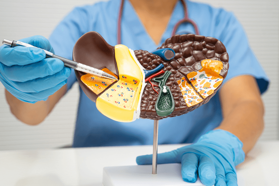 Nguyên nhân thật sự của gan nhiễm mỡ là gì