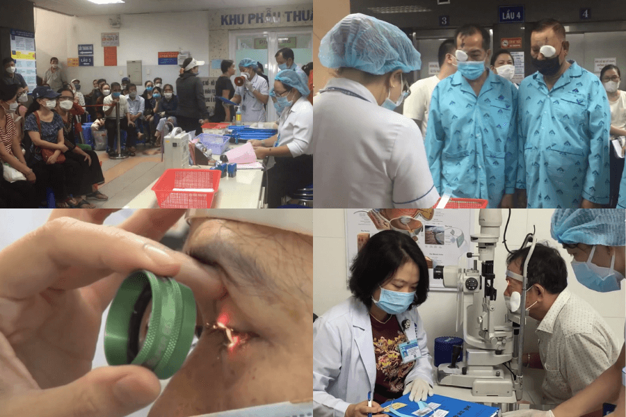 Bệnh viện Mắt TP.HCM thực hiện phẫu thuật đục thủy tinh thể (cườm khô)trung bình mỗi ngày từ 200 đến 300 ca