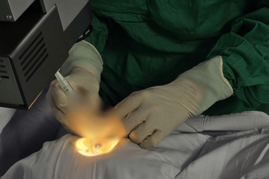 BS.CKII Trần Bá Kiền trực tiếp thực hiện phẫu thuật lấy ngòi 