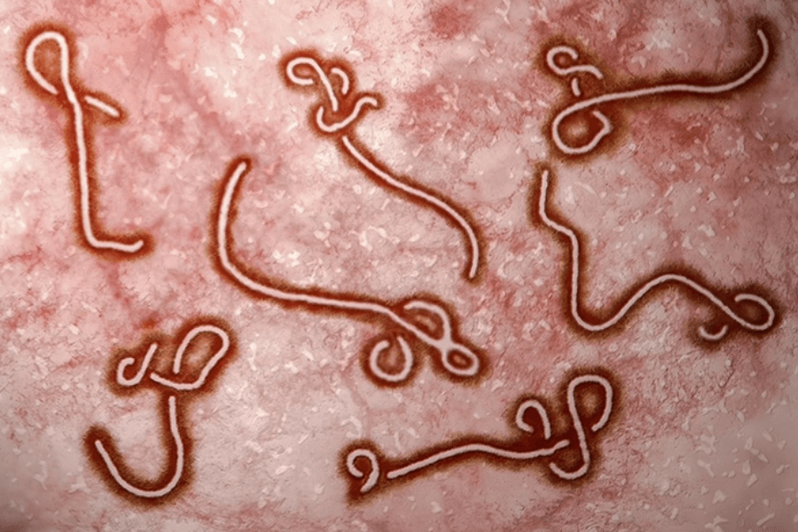Bộ Y tế cho biết WHO xếp đợt bùng phát dịch Ebola vào nhóm khẩn cấp y tế công cộng gây quan ngại quốc tế để các quốc gia tăng cường giám sát, phát hiện sớm và chuẩn bị ứng phó (Ảnh: Báo Người Lao động)