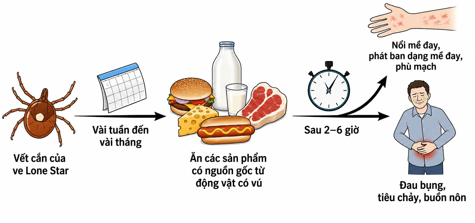 Dị ứng thịt đỏ sau khi bị ve cắn