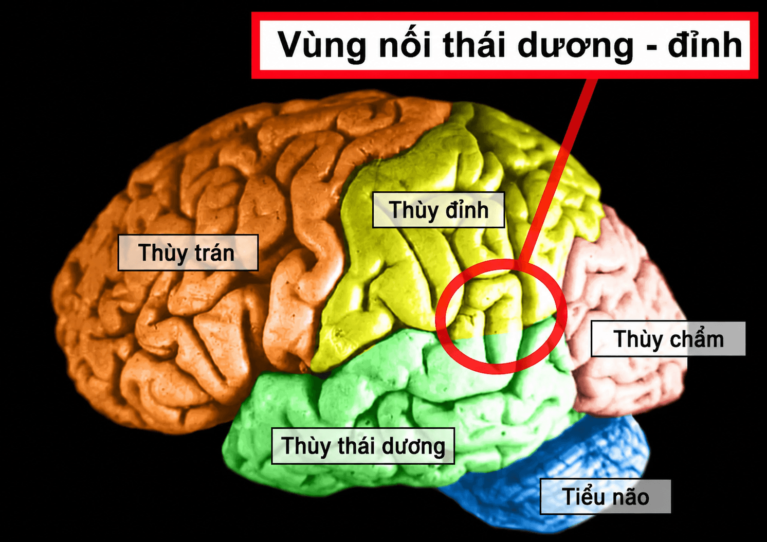Khi não bộ xử lý nhầm tín hiệu từ cơ thể