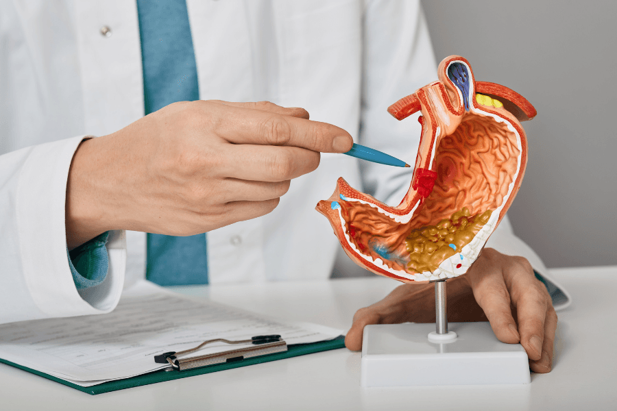 nhóm đã phẫu thuật dạ dày cần tuân thủ hướng dẫn của bác sĩ hoặc chuyên gia dinh dưỡng