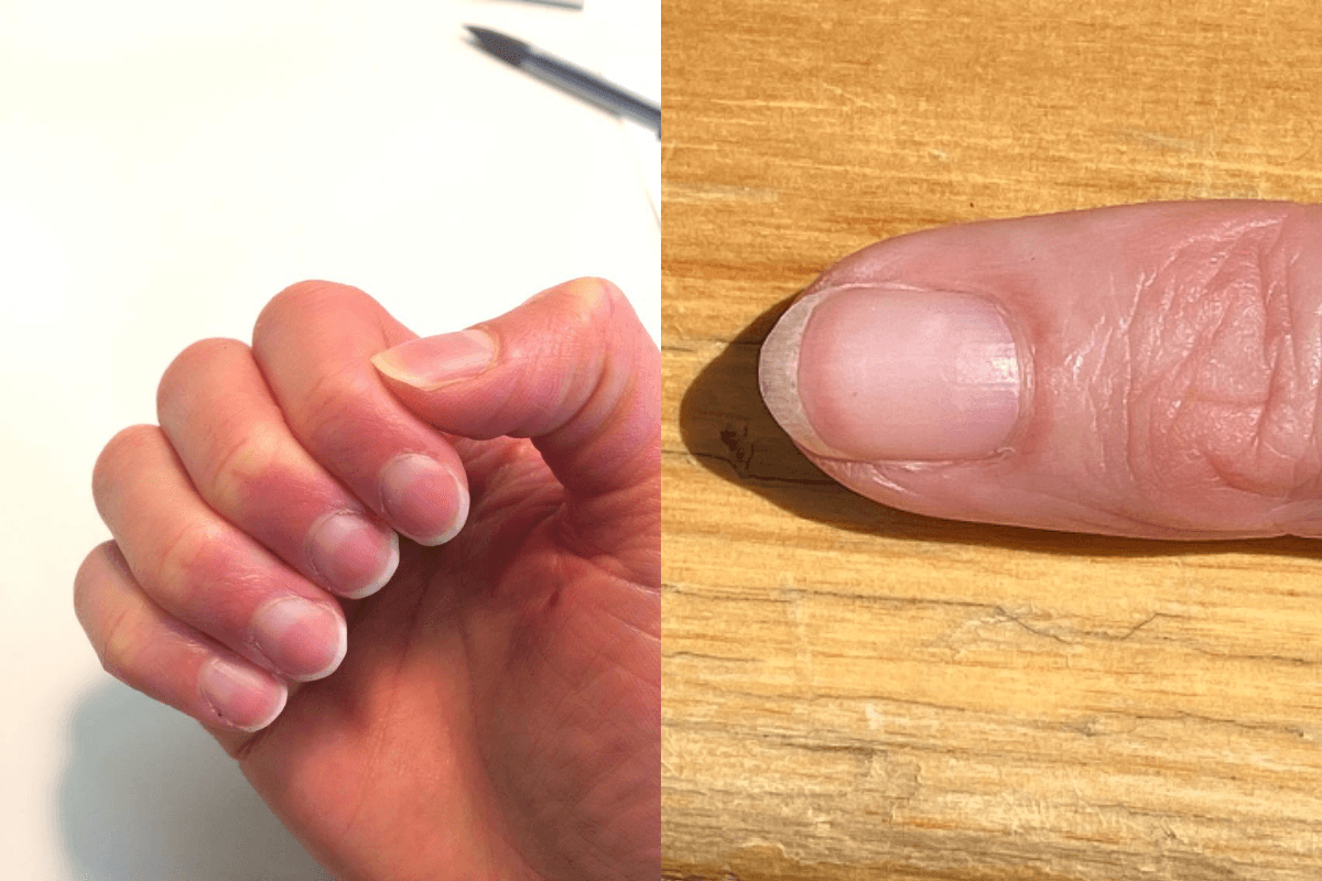 Hình bên trái là móng nửa trắng nửa hồng, hình bên phải là phần trắng chiếm phần lớn móng