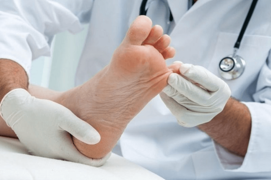 Chăm sóc bàn chân đúng cách giúp người bệnh đái tháo đường sớm nhận ra tổn thương, hạn chế nguy cơ nhiễm trùng và những biến chứng nghiêm trọng hơn