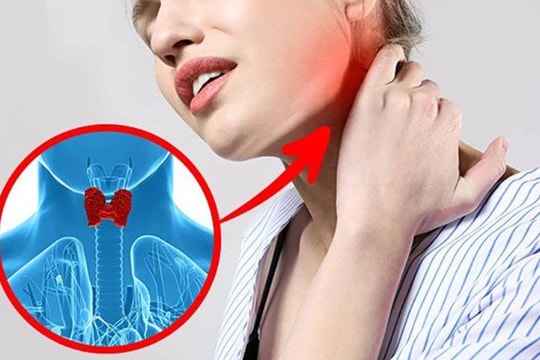 Alô! Bác sĩ ơi! Bướu tuyến giáp có khả năng bị ung thư không?