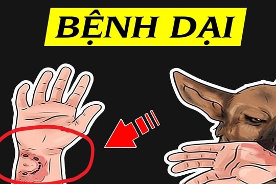 Số ca bệnh dại ở miền Nam tăng cao