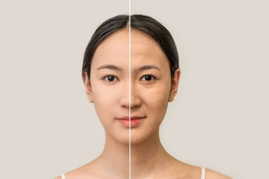 Alô, bác sĩ ơi! Da bị lão hóa, làm sao tươi trẻ hơn?