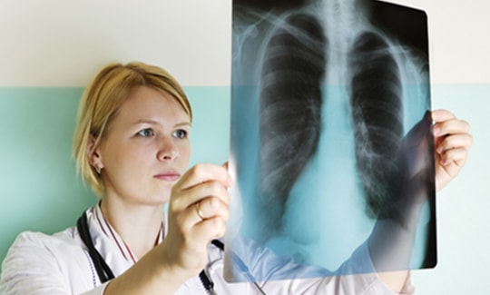 Coi chừng bệnh bụi phổi vì khó chữa hoặc không thể chữa khỏi