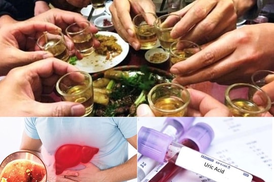 Thay đổi thói quen này có thể giúp bạn giảm axit uric trong những ngày Tết