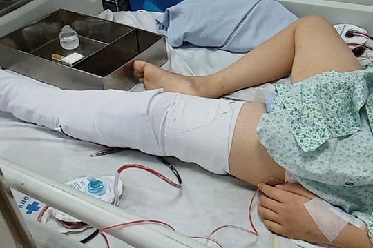 Cứu sống thành công bệnh nhi bị ung thư xương cánh tay