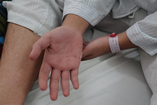 Phòng chống sốt xuất huyết mong đợi giải pháp hiệu quả, bền vững