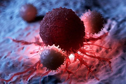 Ung thư được hình thành ra sao, cách phòng bệnh hiệu quả?