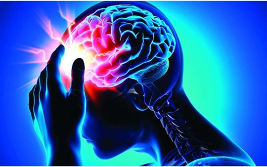 'Giờ vàng' cứu người đột quỵ: những điều bị hiểu sai