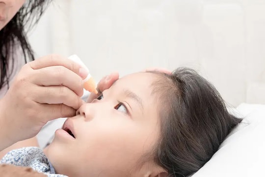 Không nên lạm dụng kháng sinh để chữa cho trẻ bị viêm kết mạc