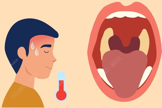 Bệnh nhiễm khuẩn bạch hầu có thể lan truyền đến TP.HCM?