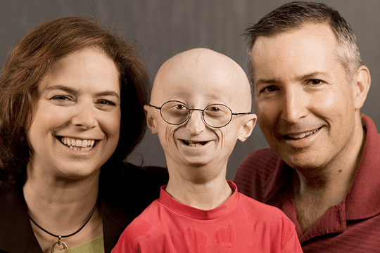 Phát hiện phương pháp chữa trị mới cho bệnh siêu hiếm Progeria ở trẻ em
