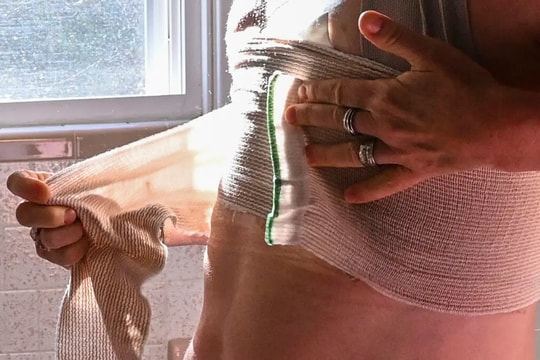 Nghiên cứu cho biết khả năng sống sót của bệnh ung thư vú không được tăng cường nhờ phẫu thuật cắt bỏ vú đôi