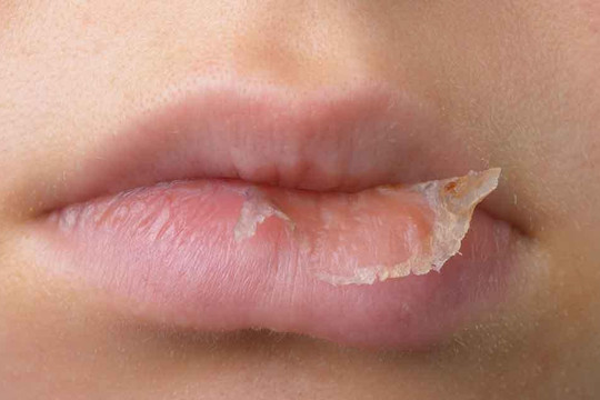 Mẹo tô son cho môi khô nẻ